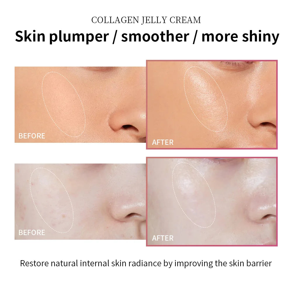 Collagen Niacinamide Jelly Cream