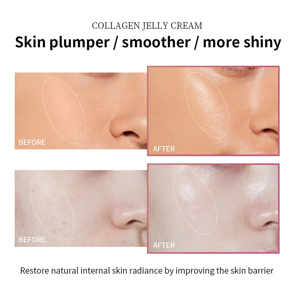 Collagen Niacinamide Jelly Cream